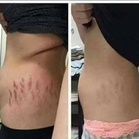 PRE-ORDER ONLY Stretch Mark & Multi-Tasking Cream - Picture 5 of 8